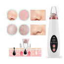 Removedor Elétrico de Cravos e Espinhas - Clear Skin Pro